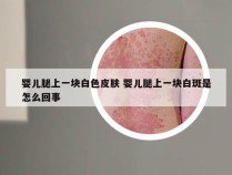 婴儿腿上一块白色皮肤 婴儿腿上一块白斑是怎么回事