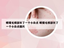 眼睫毛根部长了一个小白点 眼睫毛根部长了一个小白点图片