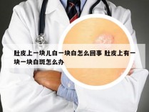 肚皮上一块儿白一块白怎么回事 肚皮上有一块一块白斑怎么办