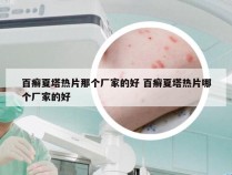 百癣夏塔热片那个厂家的好 百癣夏塔热片哪个厂家的好