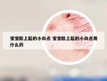 宝宝脸上起的小白点 宝宝脸上起的小白点用什么药