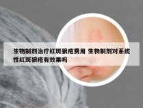 生物制剂治疗红斑狼疮费用 生物制剂对系统性红斑狼疮有效果吗