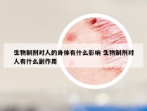 生物制剂对人的身体有什么影响 生物制剂对人有什么副作用