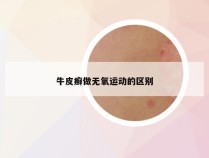 牛皮癣做无氧运动的区别