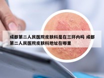 成都第二人民医院皮肤科是在三环内吗 成都第二人民医院皮肤科地址在哪里