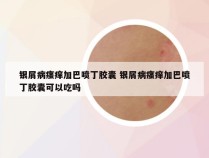 银屑病瘙痒加巴喷丁胶囊 银屑病瘙痒加巴喷丁胶囊可以吃吗