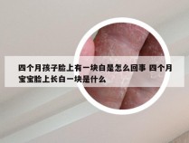 四个月孩子脸上有一块白是怎么回事 四个月宝宝脸上长白一块是什么