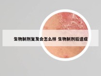 生物制剂复发会怎么样 生物制剂后遗症