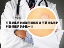 可善挺生物制剂如何医保报销 可善挺生物制剂医保报销多少钱一针