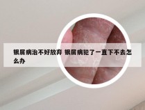 银屑病治不好放弃 银屑病犯了一直下不去怎么办