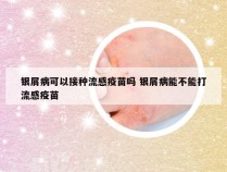 银屑病可以接种流感疫苗吗 银屑病能不能打流感疫苗