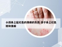 小孩身上起红色的像癣的东西 孩子身上红色斑块像癣