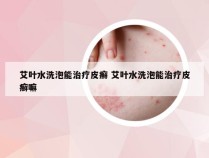 艾叶水洗泡能治疗皮癣 艾叶水洗泡能治疗皮癣嘛