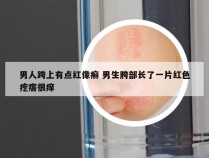 男人跨上有点红像癣 男生胯部长了一片红色疙瘩很痒