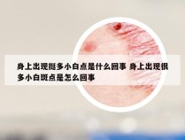 身上出现挺多小白点是什么回事 身上出现很多小白斑点是怎么回事