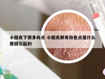 小腿皮下很多白点 小腿皮肤有白色点是什么原因引起的