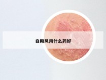 白殿风用什么药好