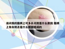 请问我的胳膊上可多白点斑是什么原因 胳膊上有白斑点是什么原因造成的