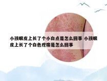 小孩眼皮上长了个小白点是怎么回事 小孩眼皮上长了个白色疙瘩是怎么回事