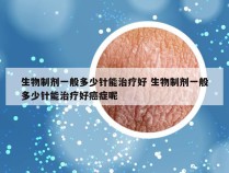 生物制剂一般多少针能治疗好 生物制剂一般多少针能治疗好癌症呢