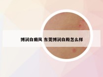 博润白癜风 东莞博润白殿怎么样