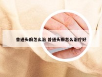 普通头癣怎么治 普通头癣怎么治疗好