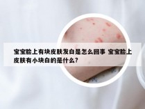 宝宝脸上有块皮肤发白是怎么回事 宝宝脸上皮肤有小块白的是什么?