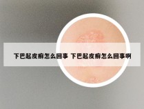 下巴起皮癣怎么回事 下巴起皮癣怎么回事啊