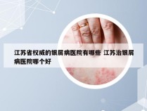 江苏省权威的银屑病医院有哪些 江苏治银屑病医院哪个好