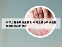 手背上有小白点是什么 手背上有小白点是什么原因引起的图片