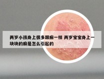 两岁小孩身上很多跟癣一样 两岁宝宝身上一块块的癣是怎么引起的