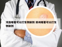 河南哪里可以打生物制剂 郑州哪里可以打生物制剂