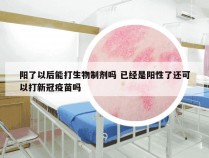 阳了以后能打生物制剂吗 已经是阳性了还可以打新冠疫苗吗