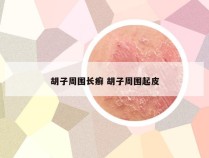 胡子周围长癣 胡子周围起皮