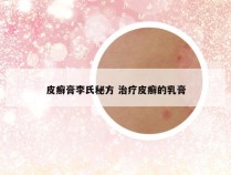 皮癣膏李氏秘方 治疗皮癣的乳膏