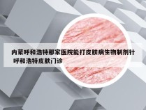 内蒙呼和浩特那家医院能打皮肤病生物制剂针 呼和浩特皮肤门诊