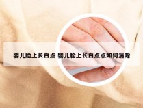 婴儿脸上长白点 婴儿脸上长白点点如何消除