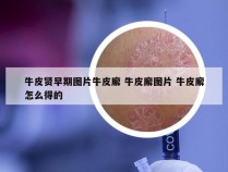 牛皮贤早期图片牛皮廨 牛皮廨图片 牛皮廨怎么得的