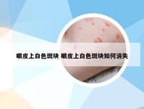 眼皮上白色斑块 眼皮上白色斑块如何消失