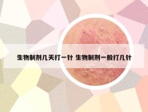 生物制剂几天打一针 生物制剂一般打几针