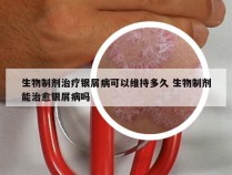 生物制剂治疗银屑病可以维持多久 生物制剂能治愈银屑病吗