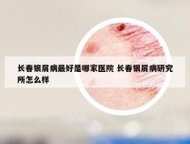 长春银屑病最好是哪家医院 长春银屑病研究所怎么样