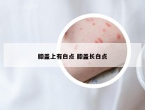 膝盖上有白点 膝盖长白点