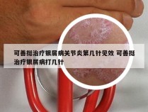 可善挺治疗银屑病关节炎第几针见效 可善挺治疗银屑病打几针