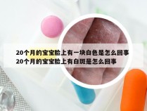 20个月的宝宝脸上有一块白色是怎么回事 20个月的宝宝脸上有白斑是怎么回事