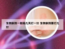 生物制剂一般隔几天打一针 生物制剂要打几针