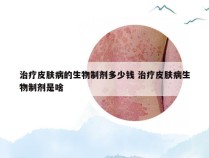 治疗皮肤病的生物制剂多少钱 治疗皮肤病生物制剂是啥