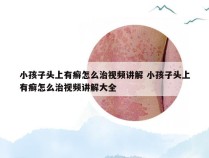 小孩子头上有癣怎么治视频讲解 小孩子头上有癣怎么治视频讲解大全