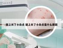 腿上长了小白点 腿上长了小白点是什么原因