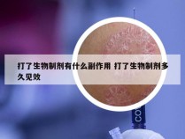 打了生物制剂有什么副作用 打了生物制剂多久见效